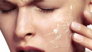 Как ухаживать за чувствительной кожей лица
